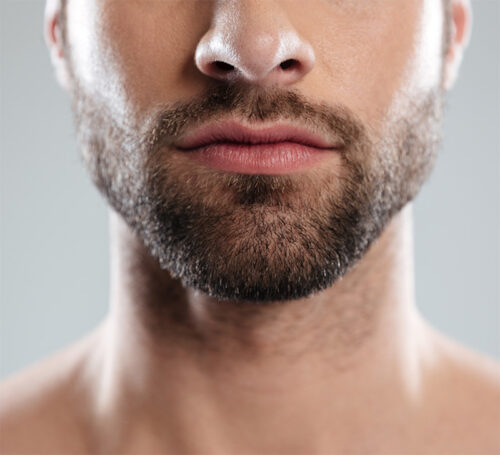 Électro-épilation pour les hommes, pour des barbes bien taillées à Verrières-le-Buisson